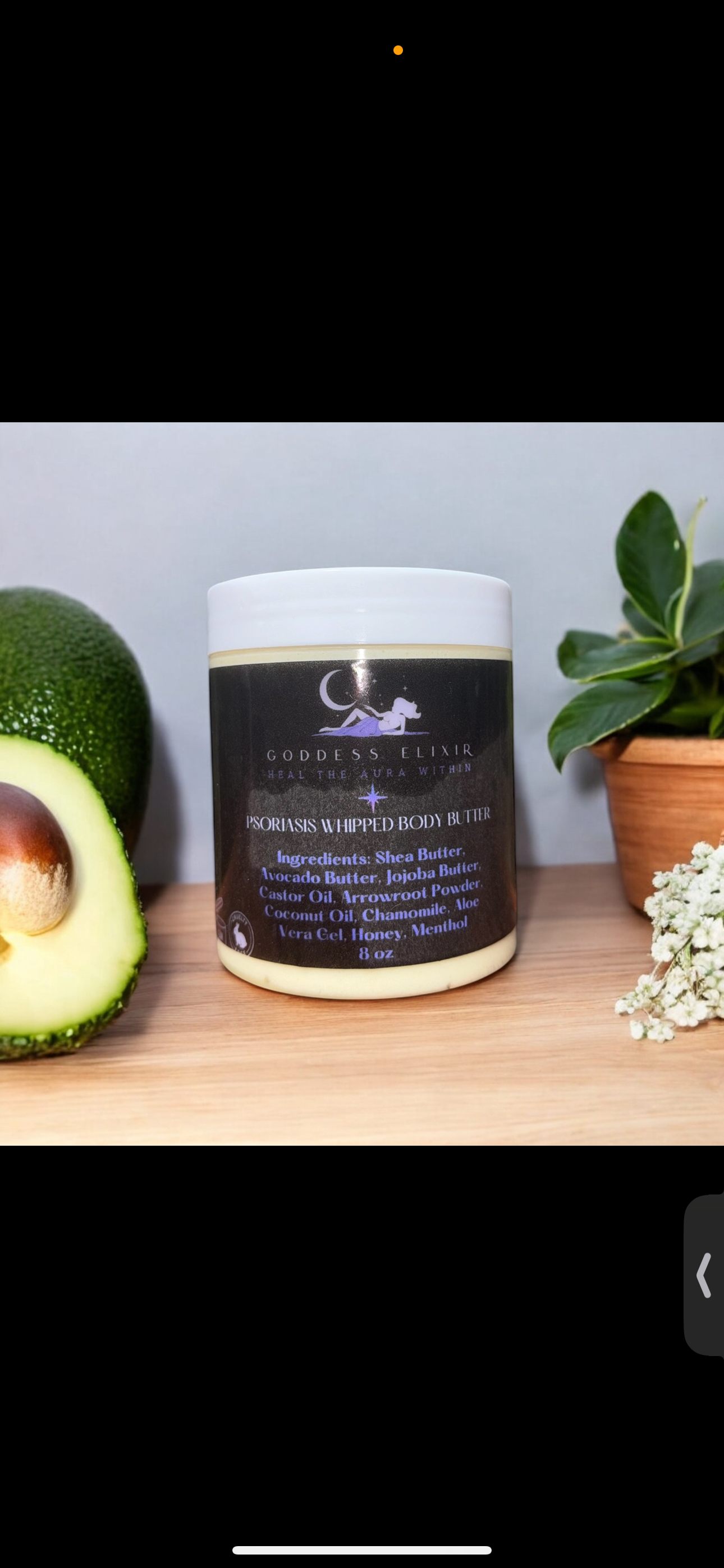Psoriasis Whipped Body Butter