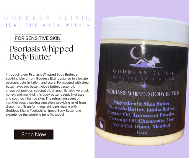 Psoriasis Whipped Body Butter