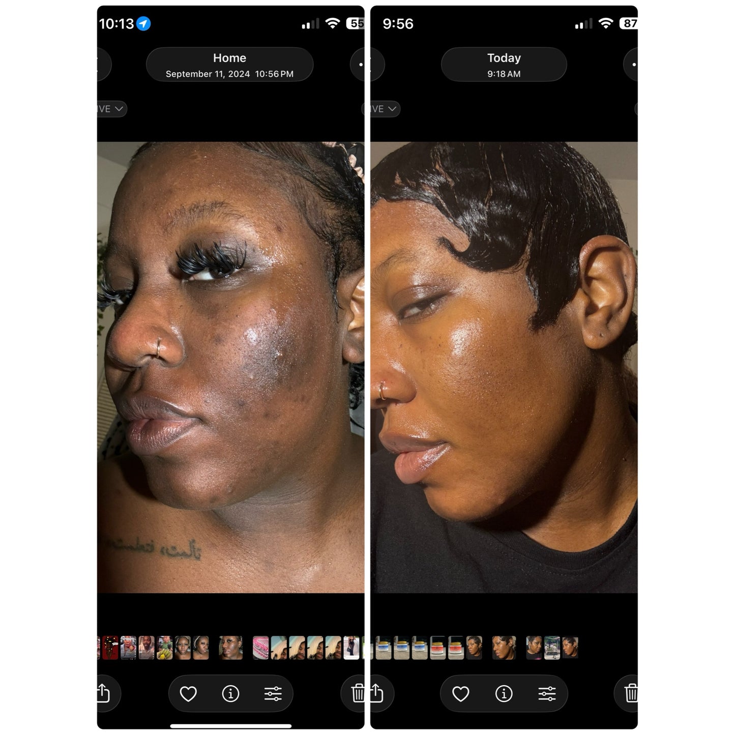 Turmeric Kojic Acid and Emu Oil Bar