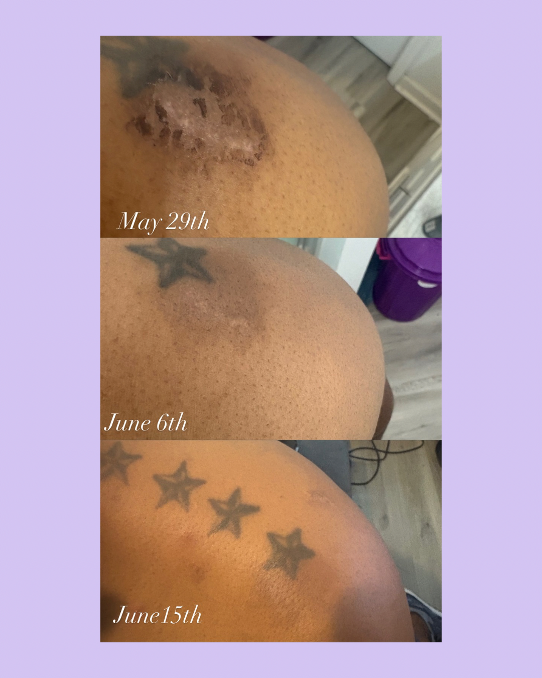 Medusa’s Elixir Hyperpigmentation Oil