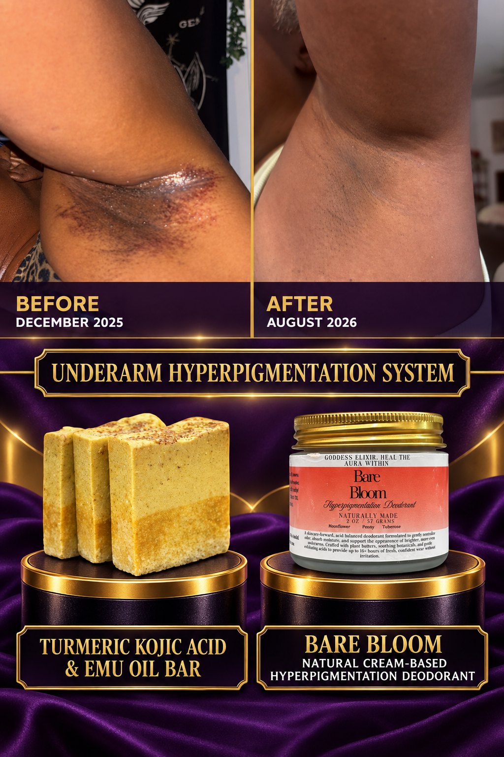 Underarm Hyperpigmentation System before and after